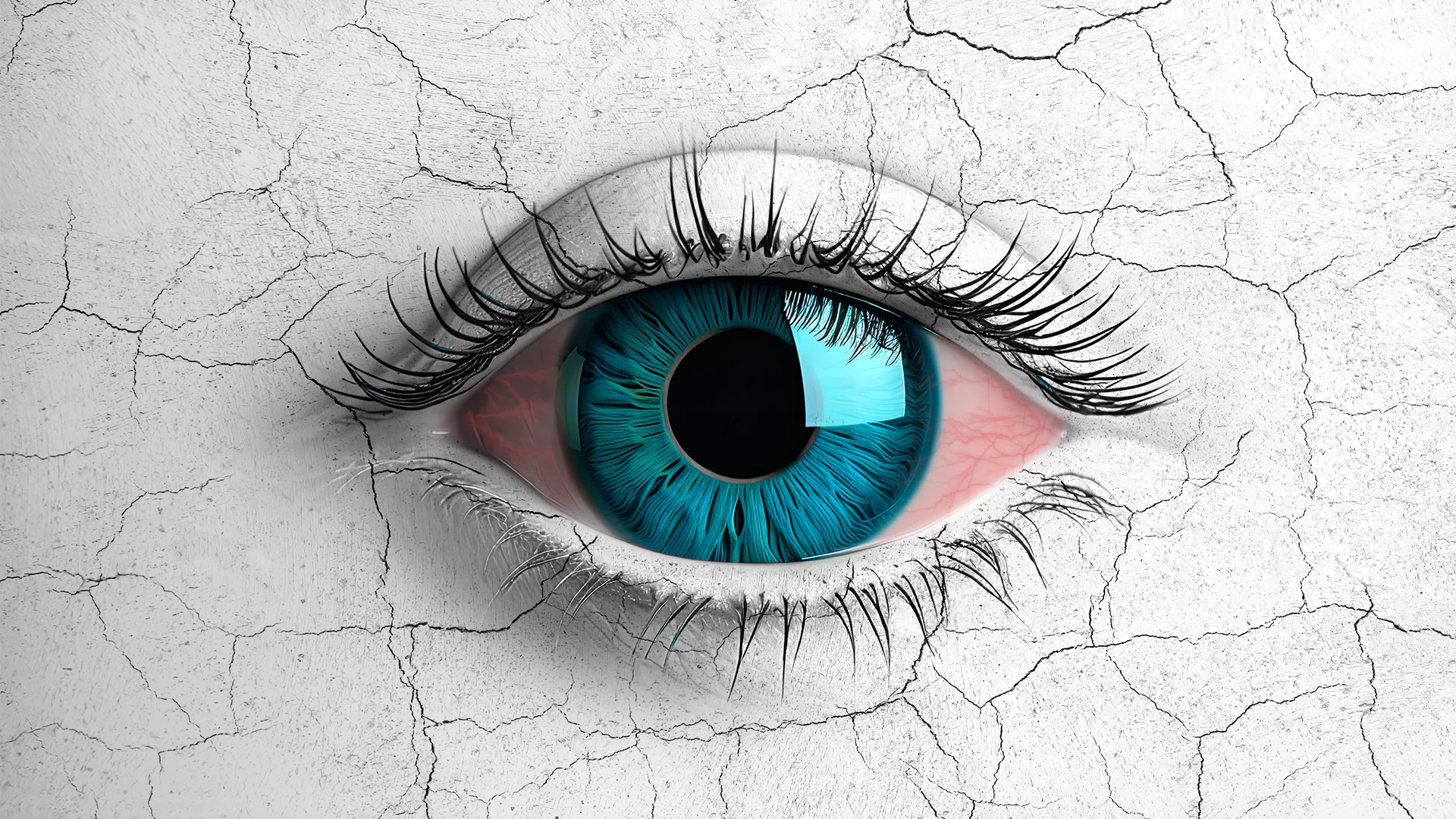 Dry eye