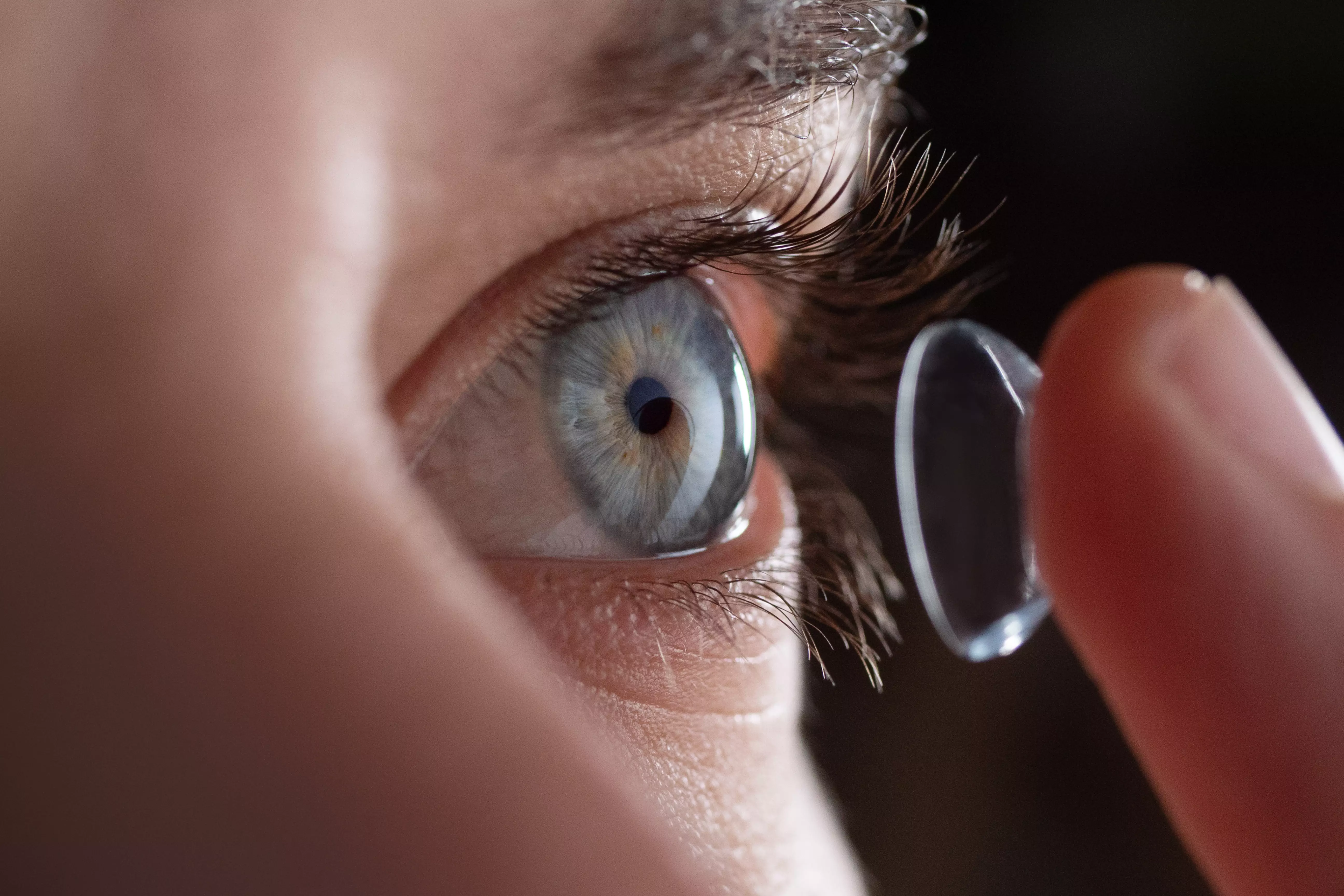Sècheresse oculaire