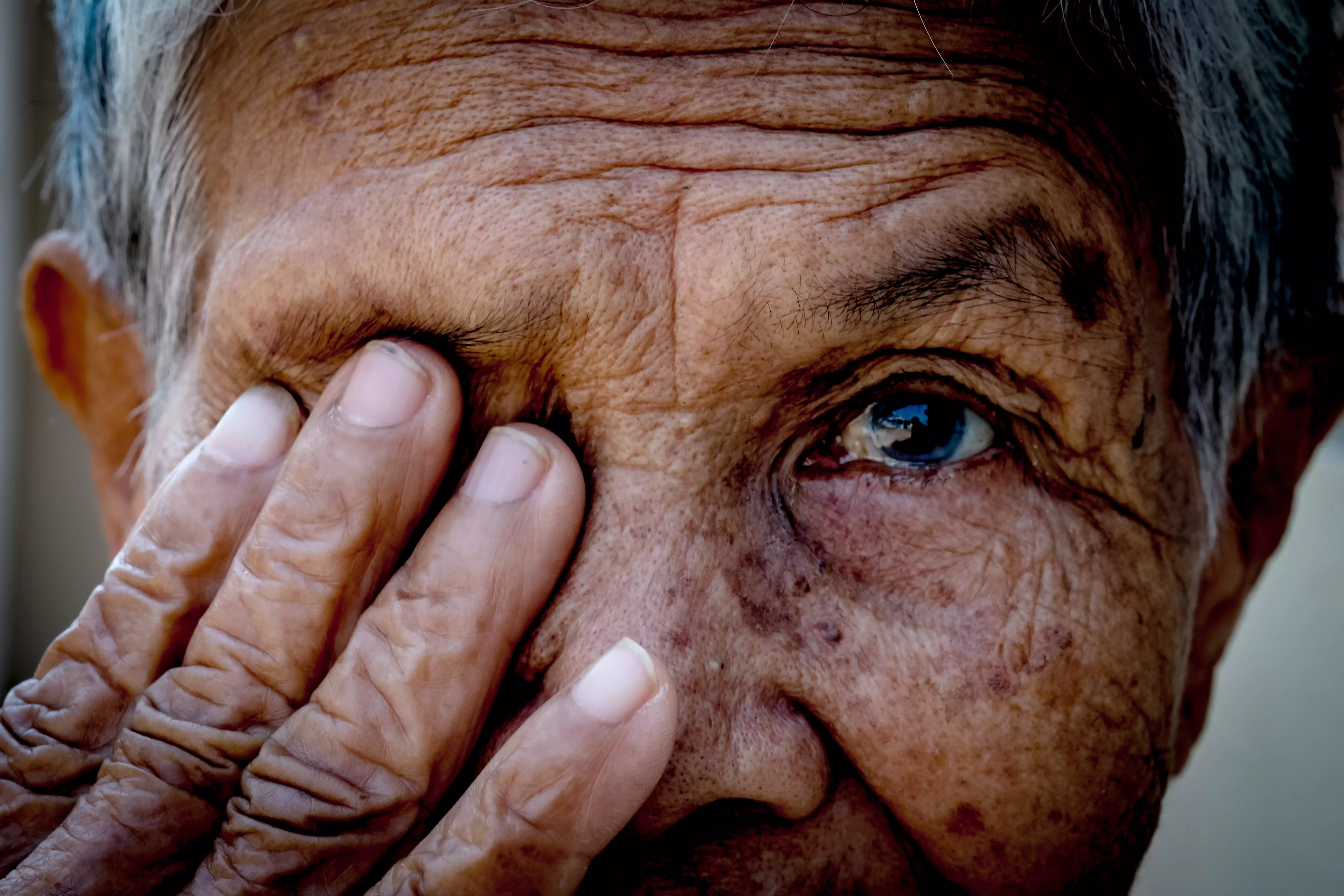 Glaucoma