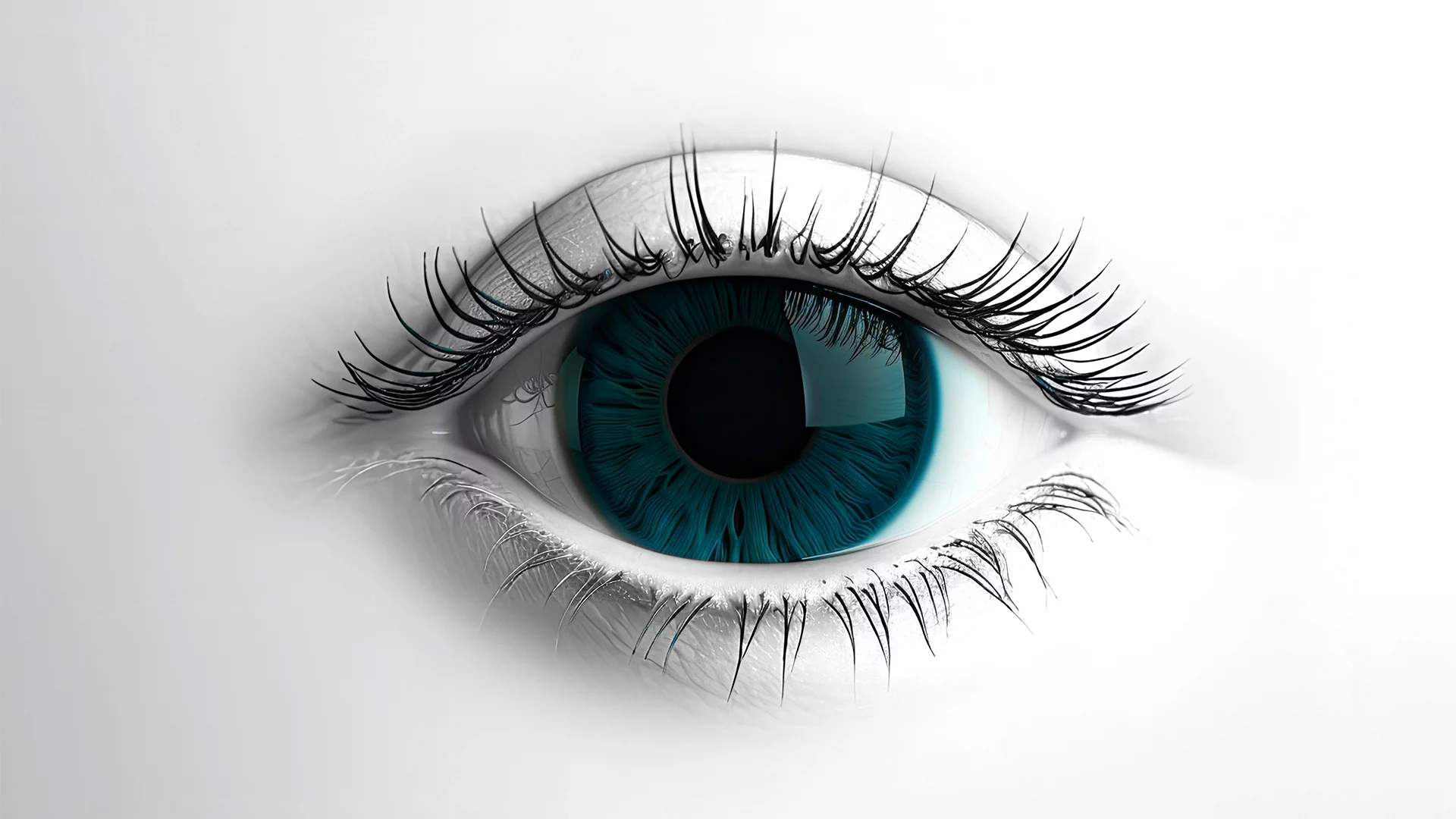 Glaucoma