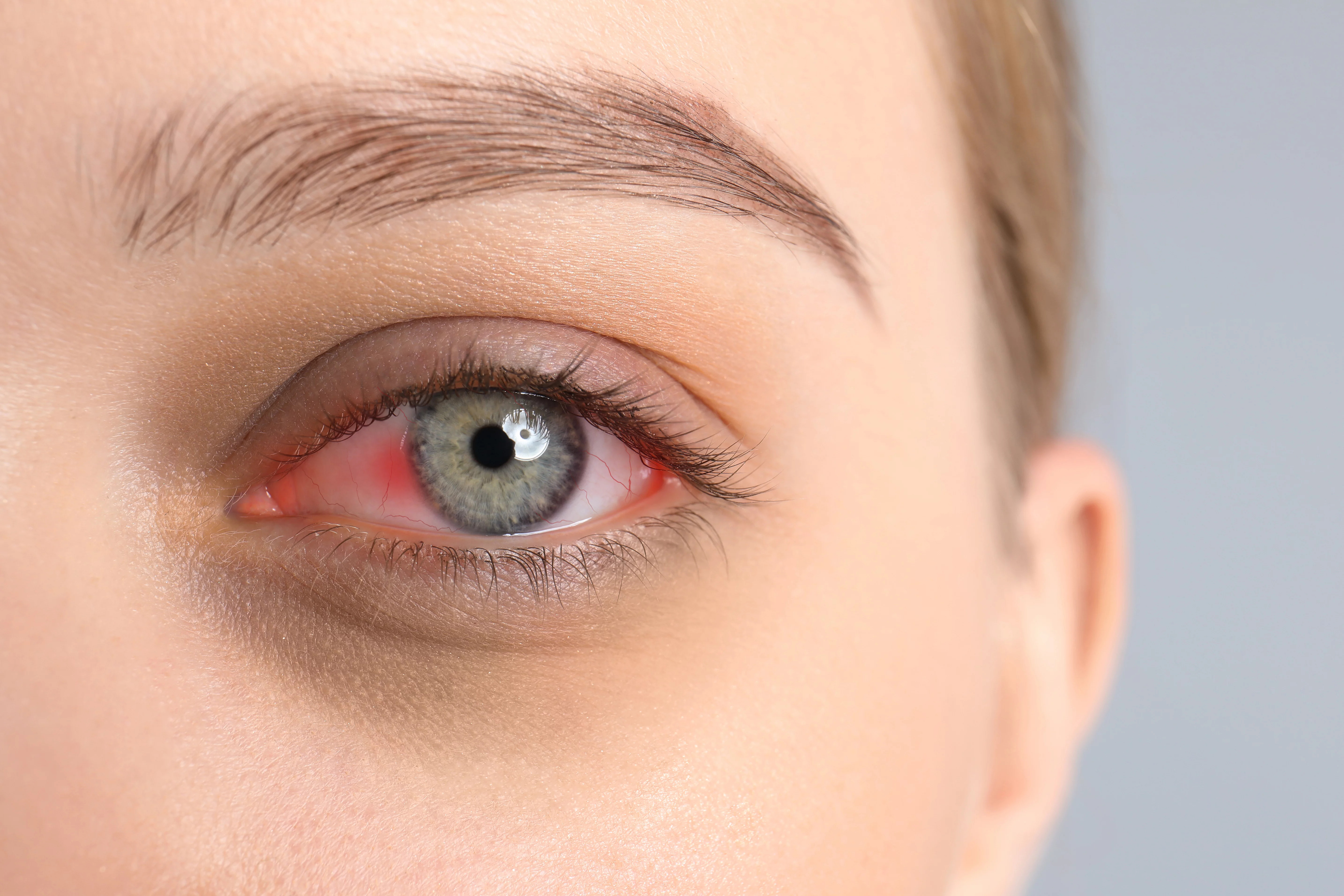 Ocular herpes