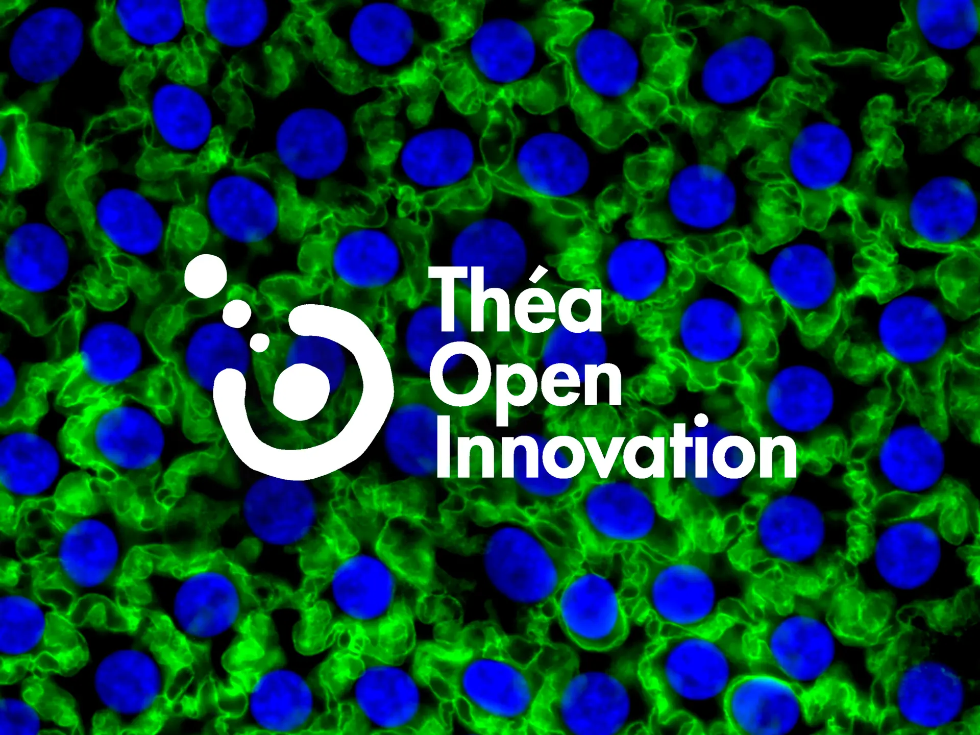 Théa Open Innovation, a structure dedicated to open innovation